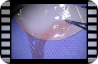 Amniotic membrane layout